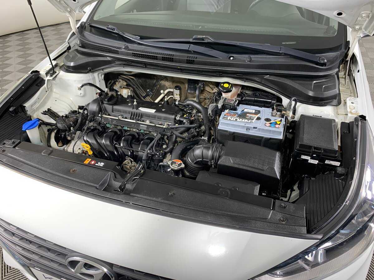 Hyundai Solaris с пробегом — 2017 год. Фото: #9